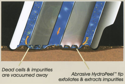 hydrafacial_diagram21.jpg